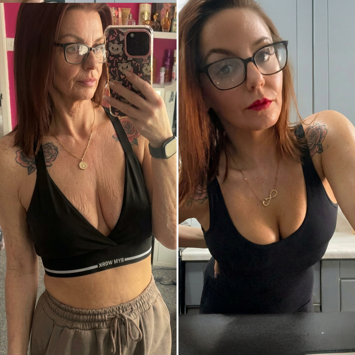 ✈️HISKIN® Mikroneedlová náplast pro podporu objemu, lifting a pevnost prsou