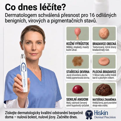 🎁 Zbývá už jen 5 kusů! Extra sleva 50 % 👩‍⚕️ Oficiální obchod Hiskin® – 7denní roll-on na odstranění skvrn a pigmentu, bezbolestný, nezanechává jizvy🐬 👉 Nenechte si ujít tuto příležitost, bude skladem až do konce roku!