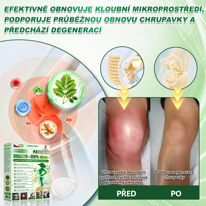 👑Zbývají už jen 4 balení! ⭐Nabízíme dodatečnou slevu 70 %! Pokud tuto šanci propásnete, další možnost se naskytne až příští rok – Moringa · Berberin × NAD+ 10 v 1 Advanced Nano 𝑨𝑵𝑮𝑬𝑳𝑻𝑹𝑨𝑷®