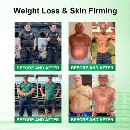𝑶𝒇𝒇𝒊𝒄𝒊𝒂𝒍 𝑺𝒕𝒐𝒓𝒆 | 𝐈𝐧𝐬𝐋𝐞𝐦𝐨𝐧® 𝑴𝒐𝒓𝒊𝒏𝒈𝗮 · 𝗕𝗲𝗿𝗯𝗲𝗿𝙞𝙣𝙚 × 𝙉𝘼𝐃+ 𝟏𝟎-𝐢𝐧-𝟏 𝗔𝗱𝘃𝗮𝗻𝗰𝙚𝙙 𝙉𝙖𝙣𝙤 𝙈𝙞𝙘𝙧𝙤𝙣𝙚𝙚𝐝𝐥𝐞 𝐏𝐚𝐭𝙘𝙝🇬🇧(𝐉𝐮𝐬𝐭 𝐨𝐧𝐜𝐞 𝐚 𝐝𝐚𝐲, 𝐯𝐢𝐬𝐢𝐛𝐥𝐞 𝐜𝐡𝐚𝐧𝐠𝐞𝐬 𝐢𝐧 𝟕 𝐝𝐚𝐲𝐬） ✅ 𝐅𝐨𝐫 𝐨𝐛𝐞𝐬𝐢𝐭𝐲, 🅛🅞🅞🅢🅔 🅢🅚🅘🅝,𝐝𝐢𝐚𝐛𝐞𝐭𝐞𝐬, 𝐬𝐥𝐞𝐞𝐩 𝐚𝐩𝐧𝐞𝐚, 𝐣𝐨𝐢𝐧𝐭 𝐢𝐬𝐬𝐮𝐞𝐬, 𝐚𝐧𝐝 𝐦𝐨𝐫𝐞💯💯