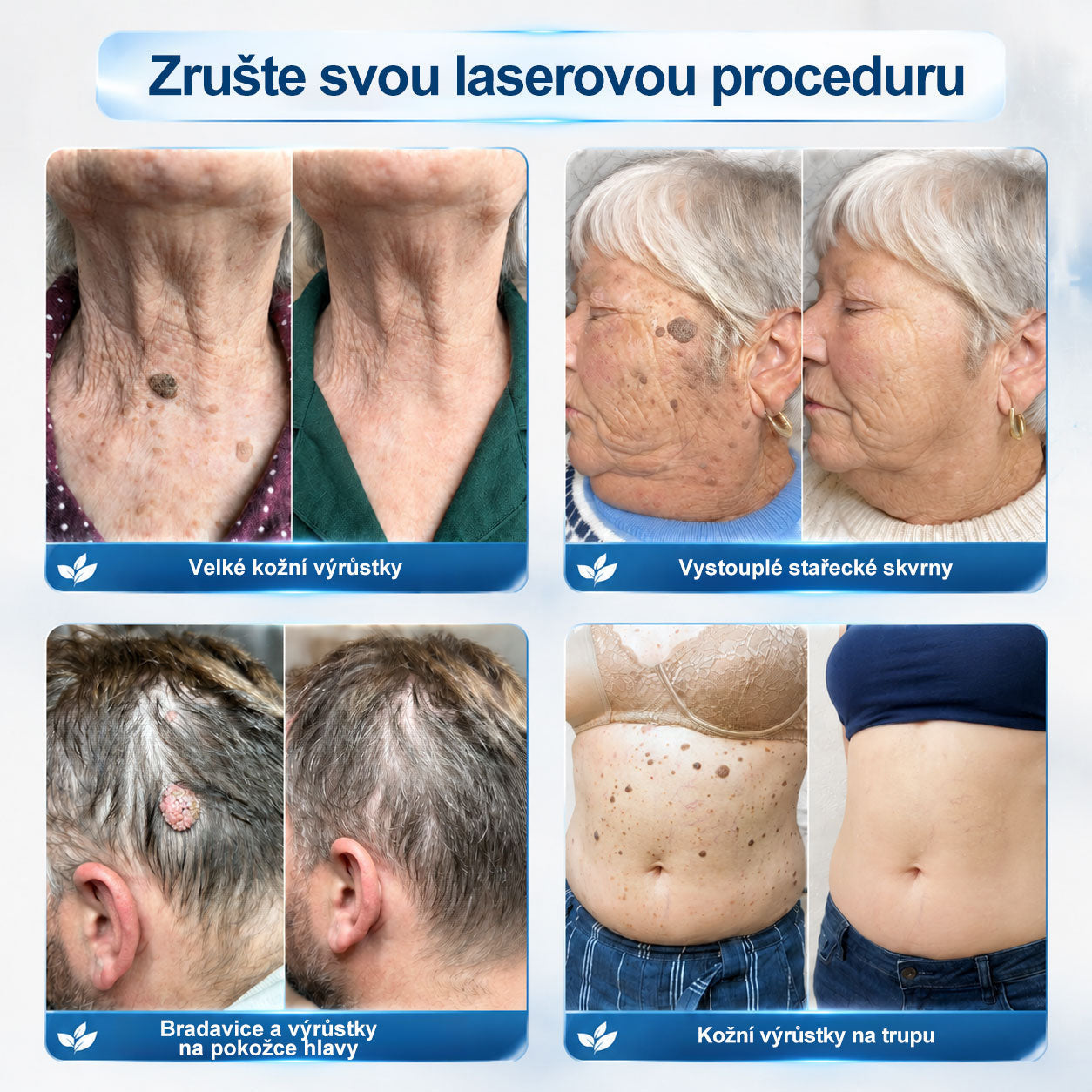🎁 Zbývá už jen 5 kusů! Extra sleva 50 % 👩‍⚕️ Oficiální obchod Hiskin® – 7denní roll-on na odstranění skvrn a pigmentu, bezbolestný, nezanechává jizvy🐬 👉 Nenechte si ujít tuto příležitost, bude skladem až do konce roku!