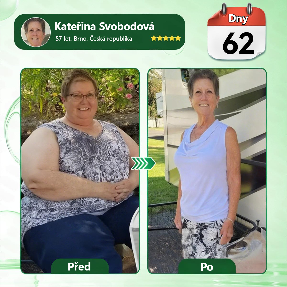 👑Zbývají už jen 4 balení! ⭐Nabízíme dodatečnou slevu 70 %! Pokud tuto šanci propásnete, další možnost se naskytne až příští rok – Moringa · Berberin × NAD+ 10 v 1 Advanced Nano 𝑨𝑵𝑮𝑬𝑳𝑻𝑹𝑨𝑷®