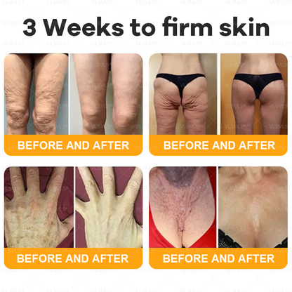 Made and Shipped from UK 🎗️🎗️VLSVLS® Bee Venom Comprehensive Cream  LAST DAY 80% OFF (Suitable for all ages)