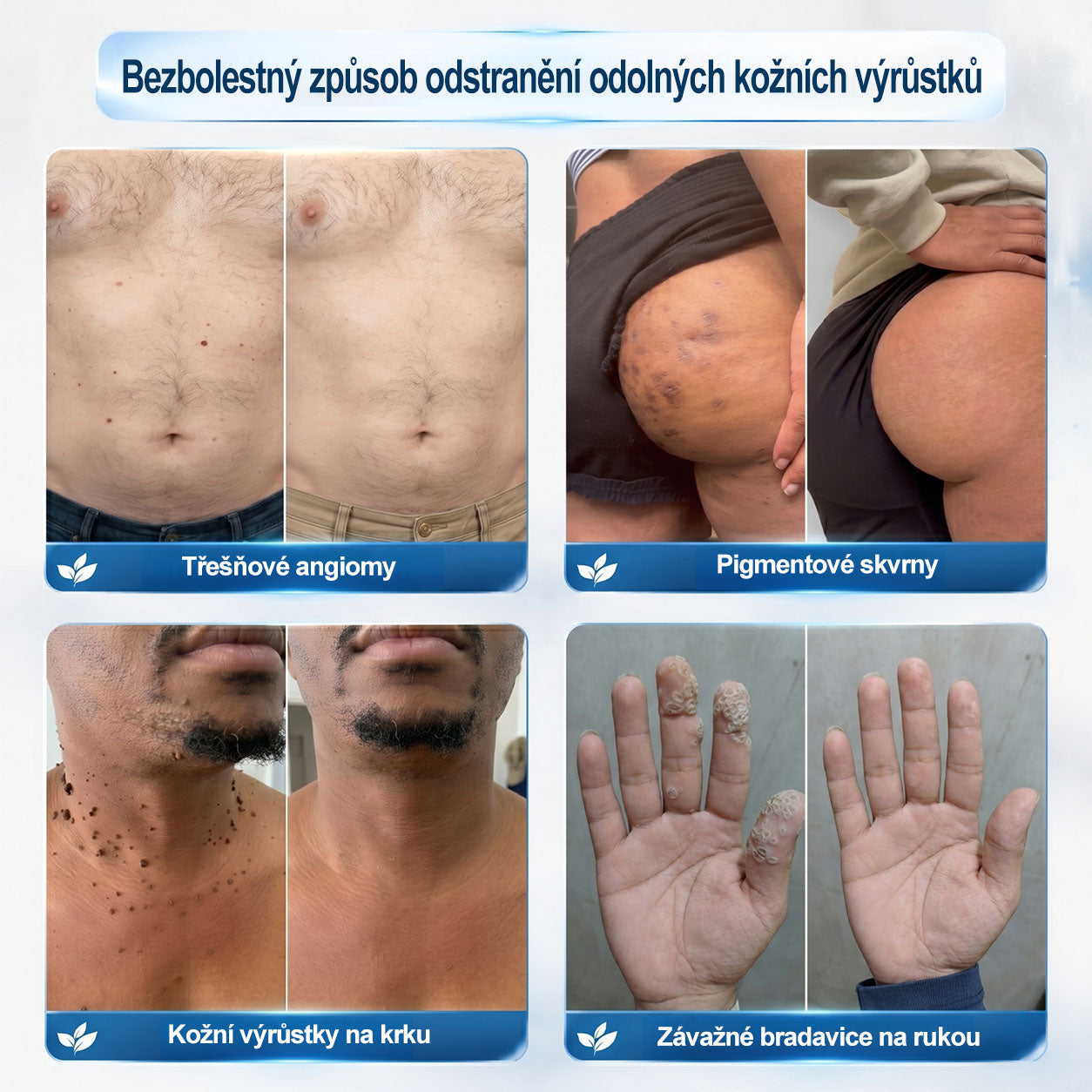 💛✅Oficiální značkový obchod | Hiskin® 7denní odstraňovač skvrn a pigmentových skvrn (Bezbolestný rollerball bez jizev)🐬