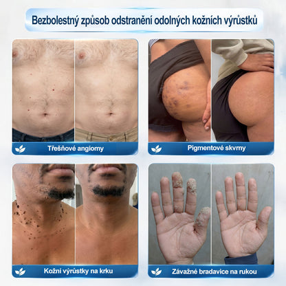 🎁 Zbývá už jen 5 kusů! Extra sleva 50 % 👩‍⚕️ Oficiální obchod Hiskin® – 7denní roll-on na odstranění skvrn a pigmentu, bezbolestný, nezanechává jizvy🐬 👉 Nenechte si ujít tuto příležitost, bude skladem až do konce roku!