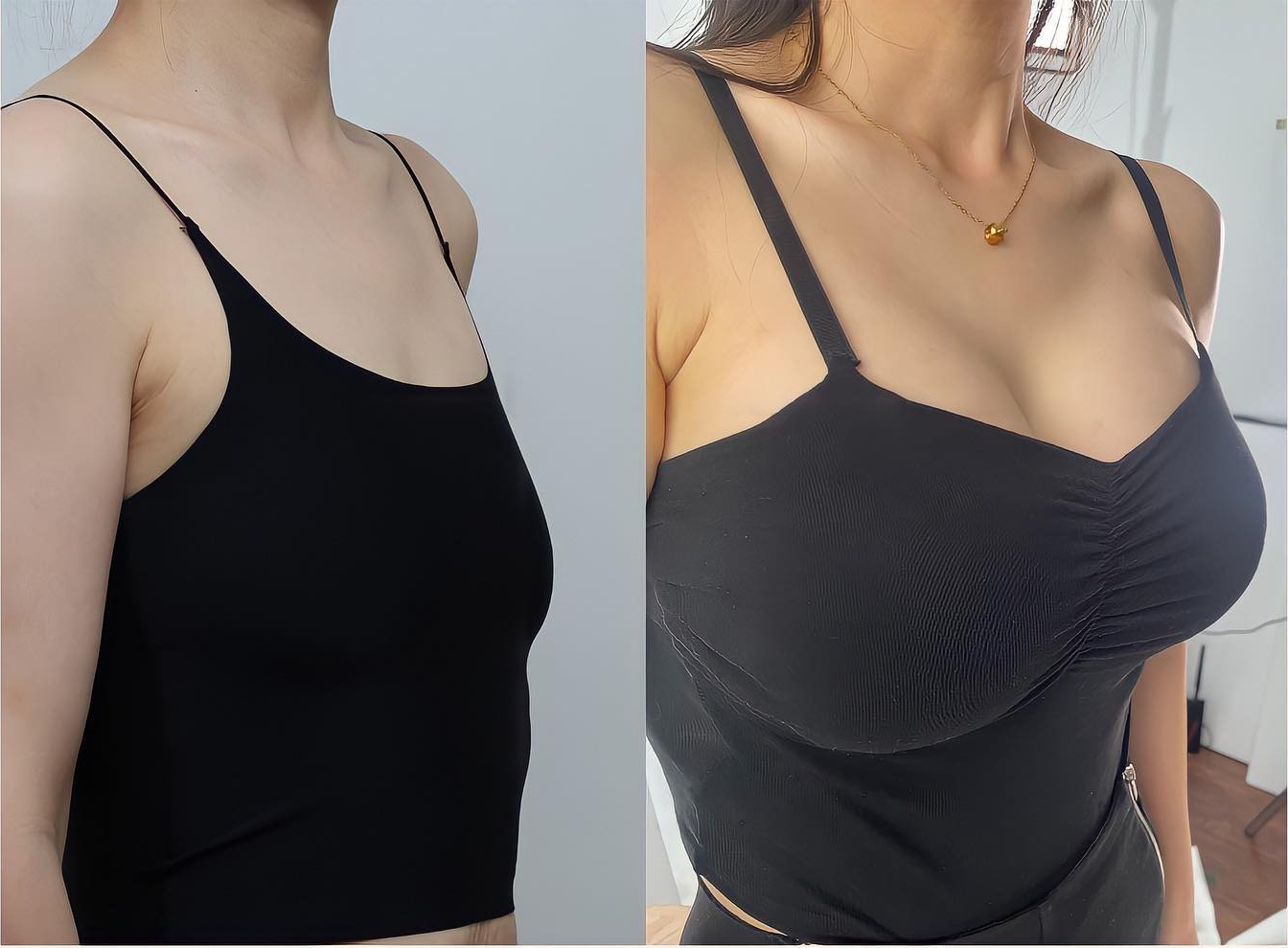 ✈️HISKIN® Mikroneedlová náplast pro podporu objemu, lifting a pevnost prsou