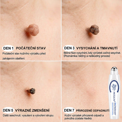 🎁 Zbývá už jen 5 kusů! Extra sleva 50 % 👩‍⚕️ Oficiální obchod Hiskin® – 7denní roll-on na odstranění skvrn a pigmentu, bezbolestný, nezanechává jizvy🐬 👉 Nenechte si ujít tuto příležitost, bude skladem až do konce roku!