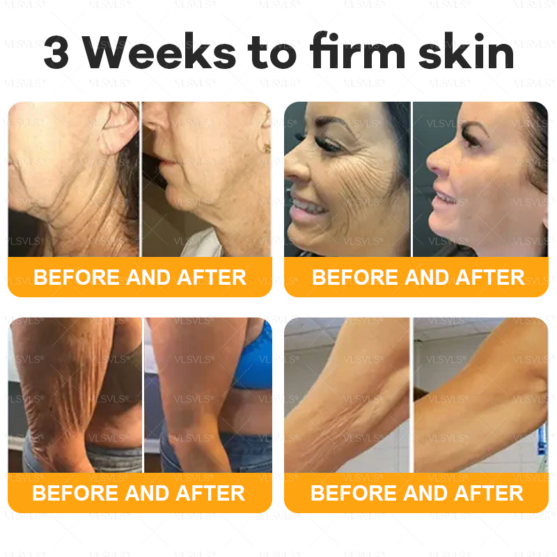 Made and Shipped from UK 🎗️🎗️VLSVLS® Bee Venom Comprehensive Cream  LAST DAY 80% OFF (Suitable for all ages)