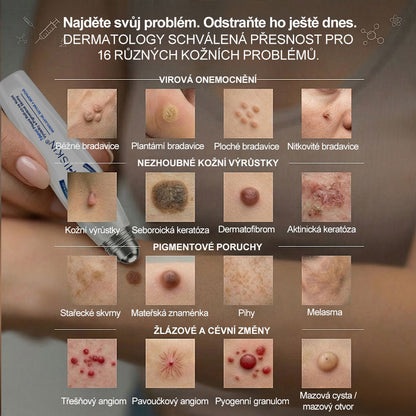🎁 Zbývá už jen 5 kusů! Extra sleva 50 % 👩‍⚕️ Oficiální obchod Hiskin® – 7denní roll-on na odstranění skvrn a pigmentu, bezbolestný, nezanechává jizvy🐬 👉 Nenechte si ujít tuto příležitost, bude skladem až do konce roku!
