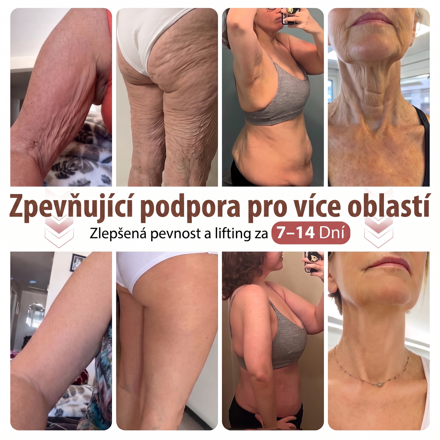 ✈️HISKIN® Mikroneedlová náplast pro podporu objemu, lifting a pevnost prsou