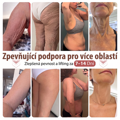 ✈️HISKIN® Mikroneedlová náplast pro podporu objemu, lifting a pevnost prsou