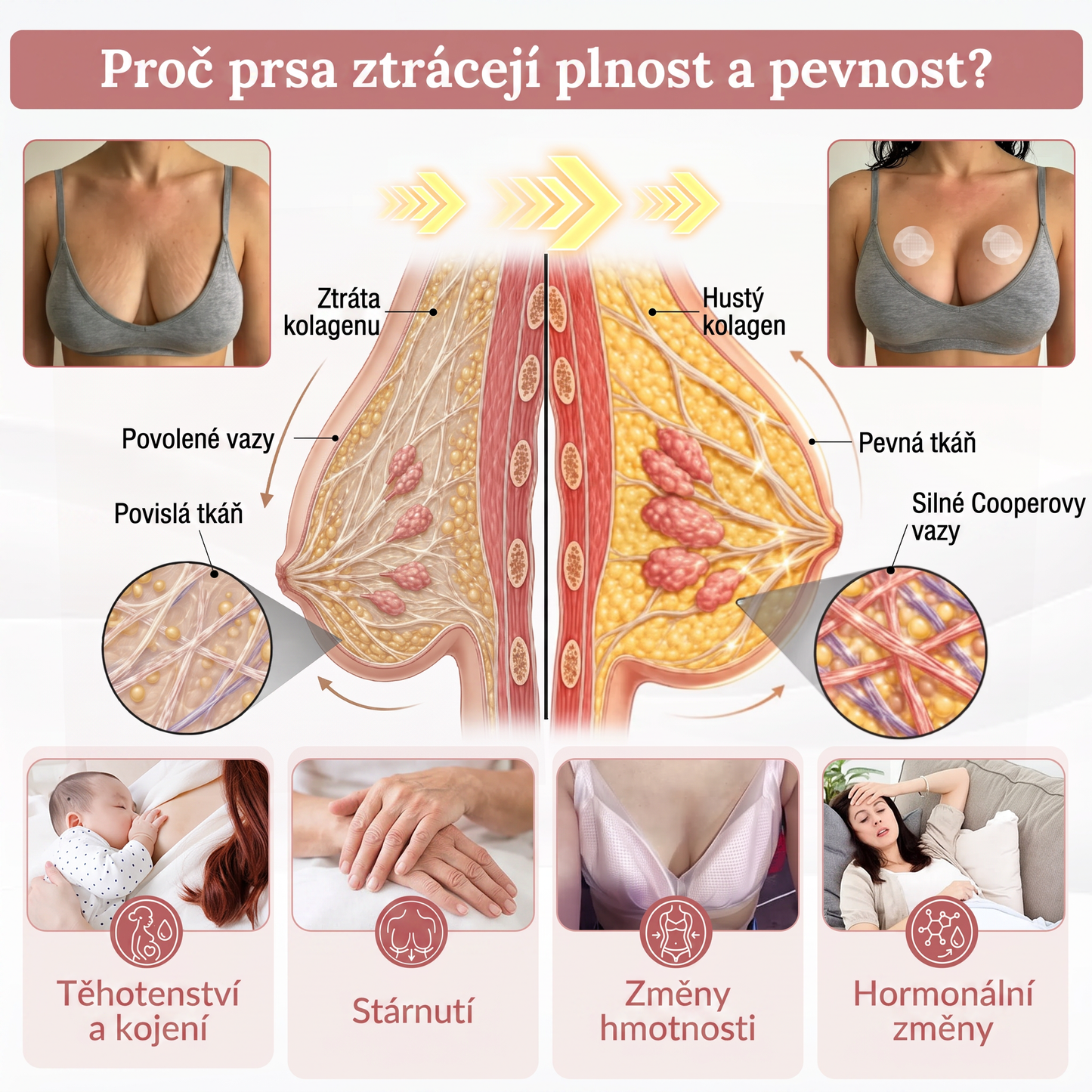 ✈️HISKIN® Mikroneedlová náplast pro podporu objemu, lifting a pevnost prsou